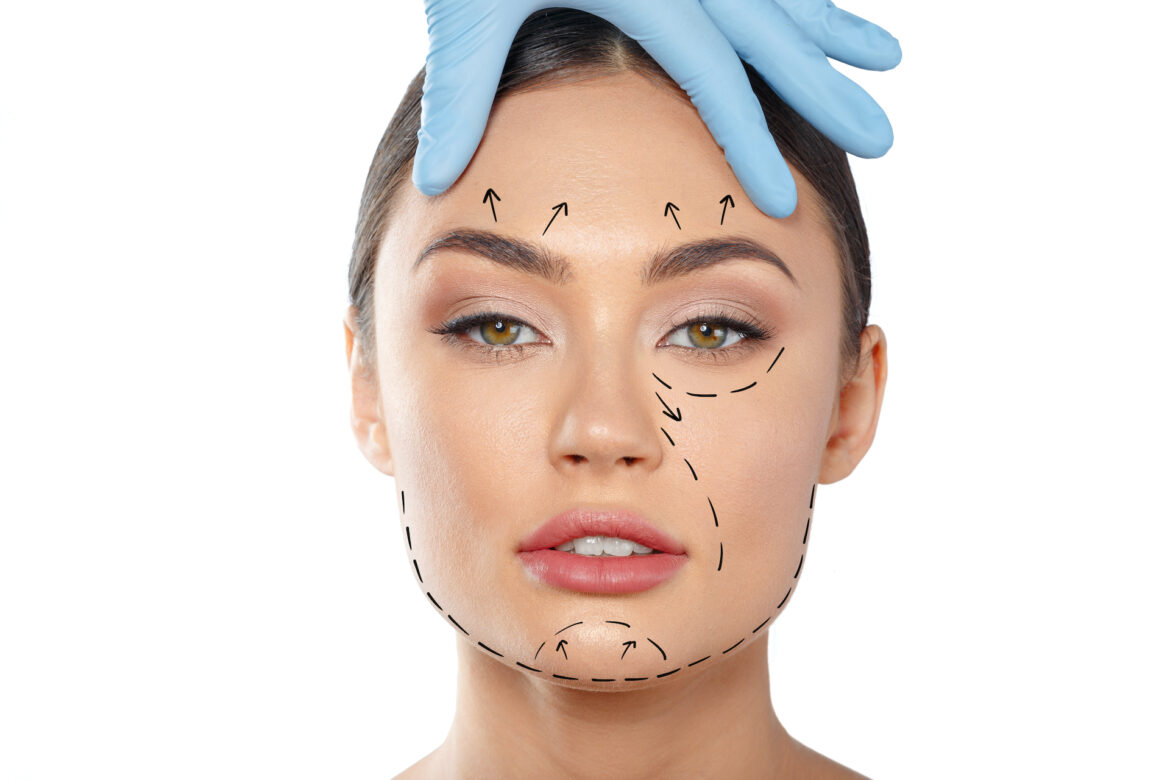 7armonizacion-facial-1170x780